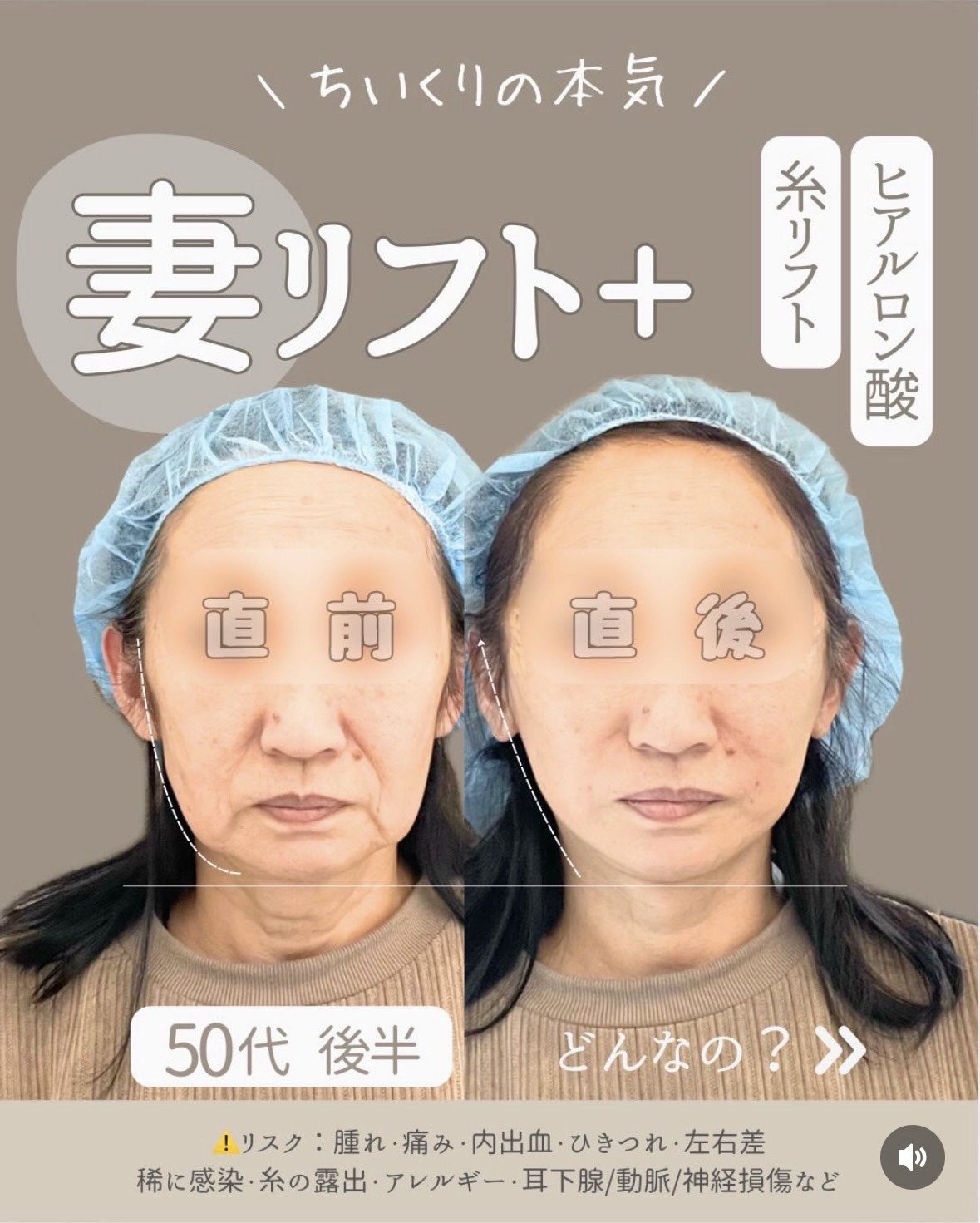 50代後半・妻リフト＋
