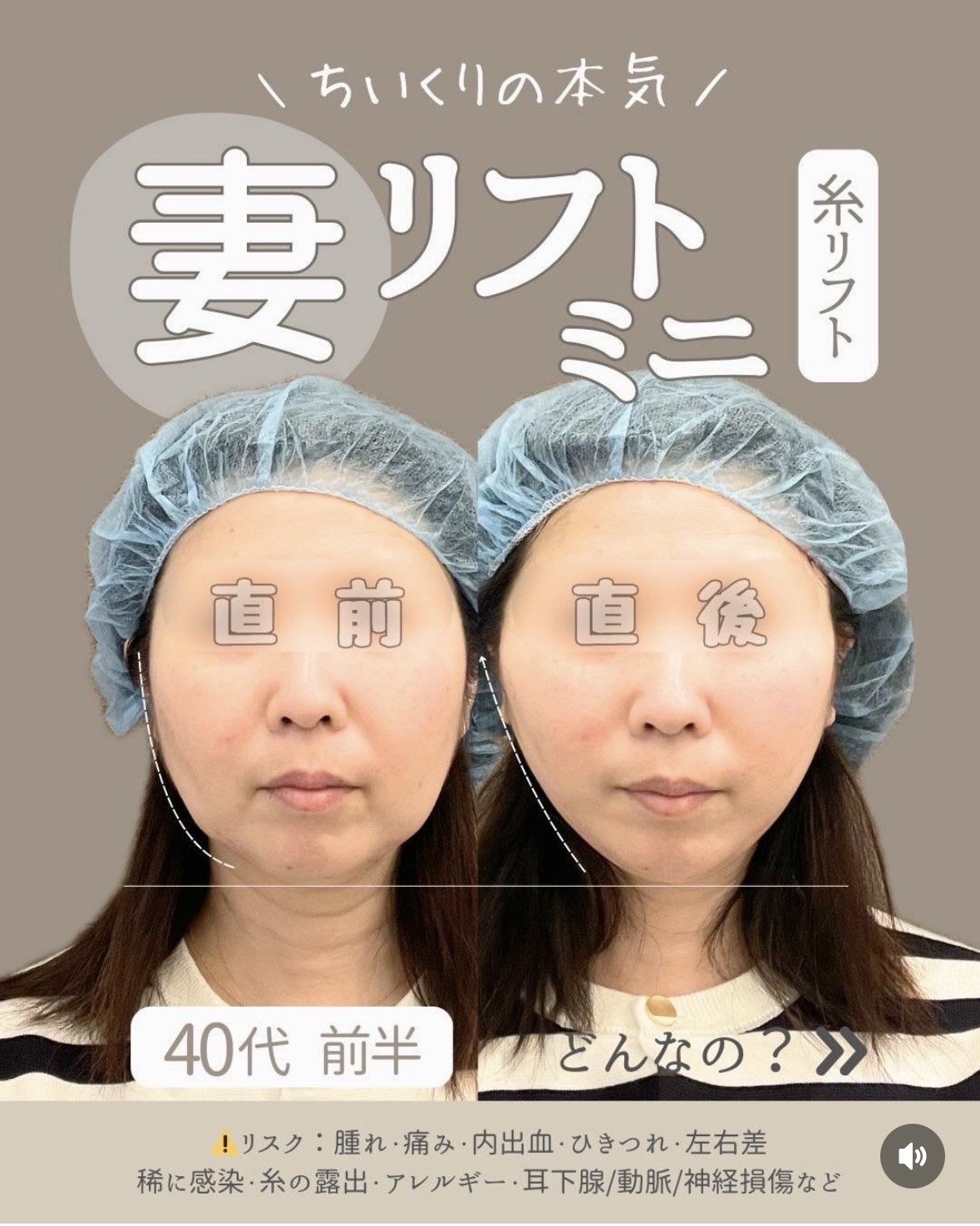 40代前半・妻リフトミニ