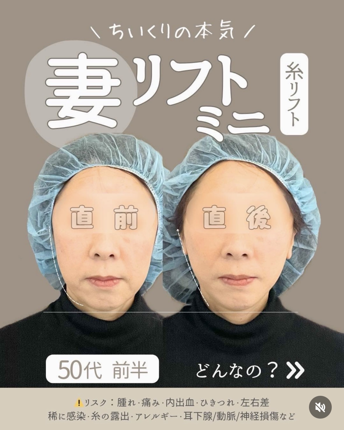 50代前半・妻リフトミニ（4回目）