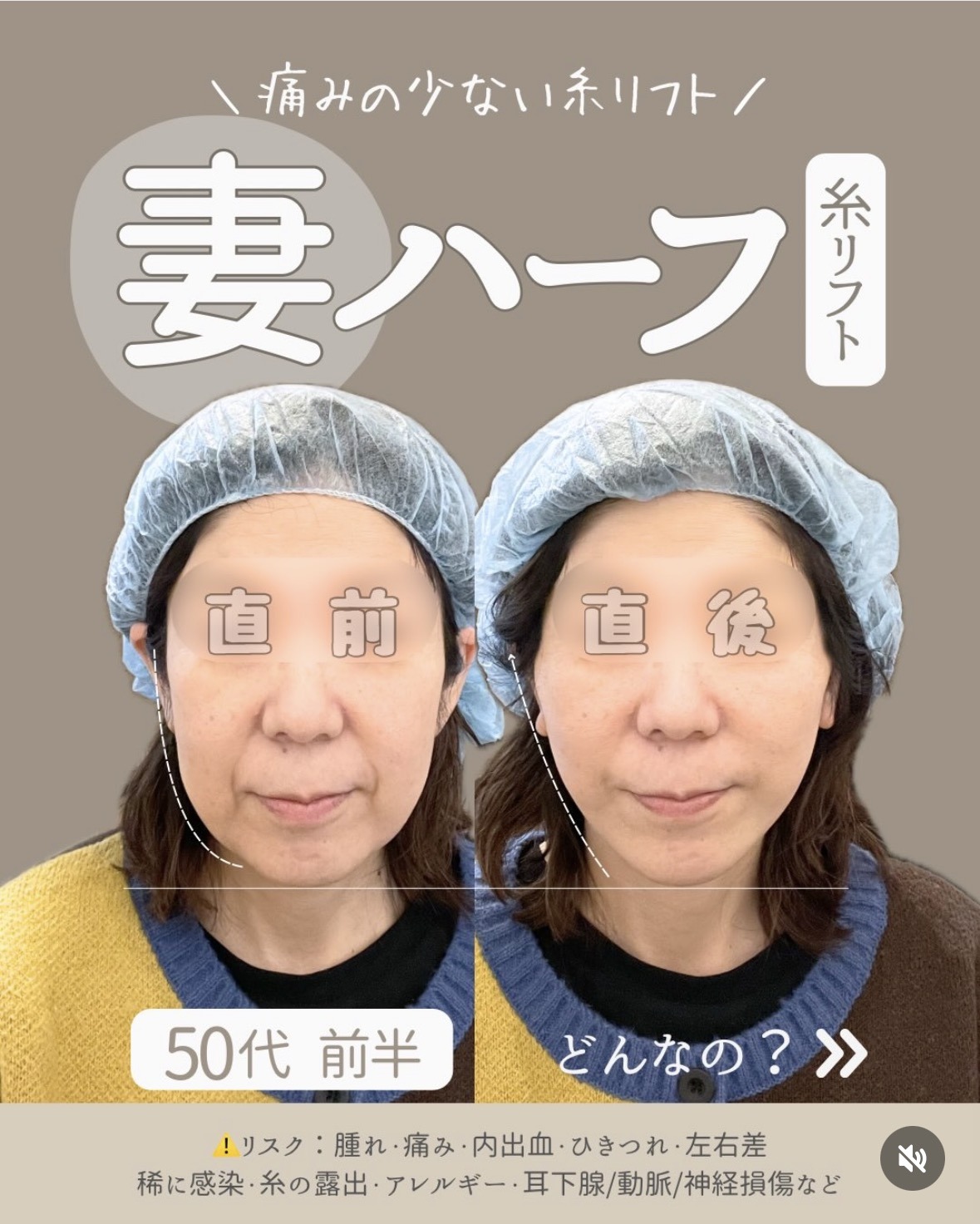 50代前半・妻ハーフ（初回）